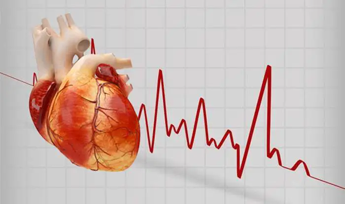 11 síntomas principales de la arritmia cardíaca